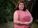 Rachel Anderson of Skegness, Lincolnshire after recovering from a horrific dog attack.