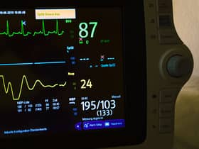 British Heart Foundation said the number of people with a heart rhythm condition has passed 1.5 million.