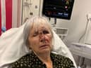 Glenn Lilley after she fell face first into the door as she collapsed before the tumour was discovered. 