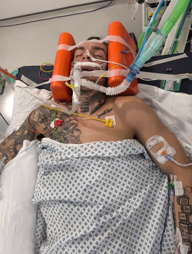 Sam had to be put into a coma