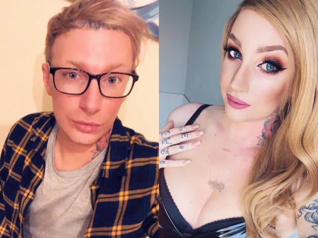 Chelsea Burwin before and after surgery