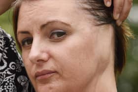 Anthea Smith paid a heavy price for regularly tanning