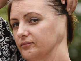 Anthea Smith paid a heavy price for regularly tanning