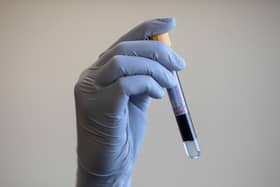 A blood sample is held during a Covid-19 antibody testing program
