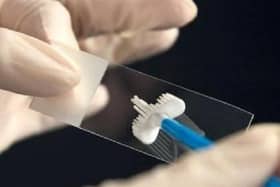 Smear tests are life-saving
