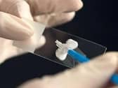 Smear tests are life-saving