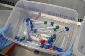 Test tubes containing live samples taken from people tested for the novel coronavirus.