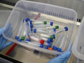 Test tubes containing live samples taken from people tested for the novel coronavirus.