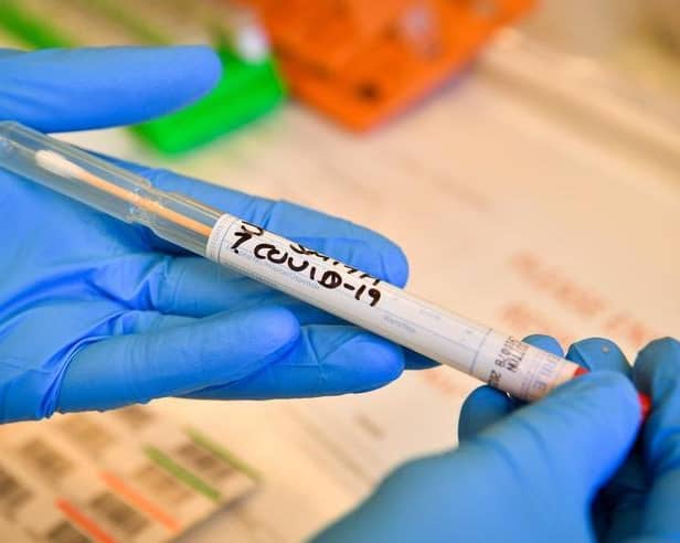 Researchers say that characteristic skinrashes and "Covid fingers and toes" can occur in the absence of any other symptoms and therefore should be considered when diagnosing Covid-19.
