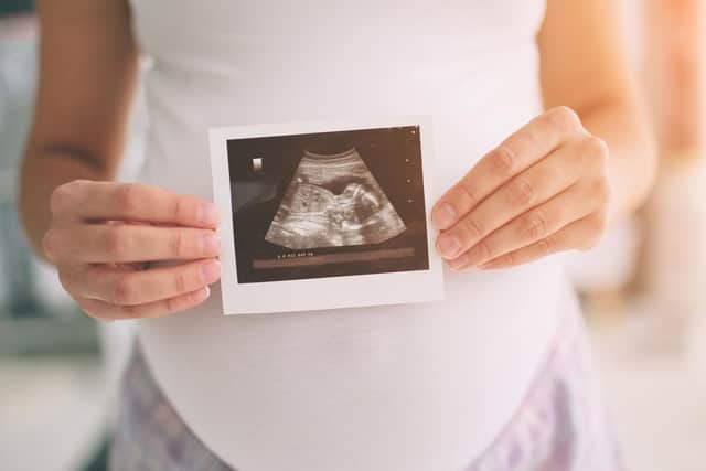 Pregnant women have been forced to attend scans alone