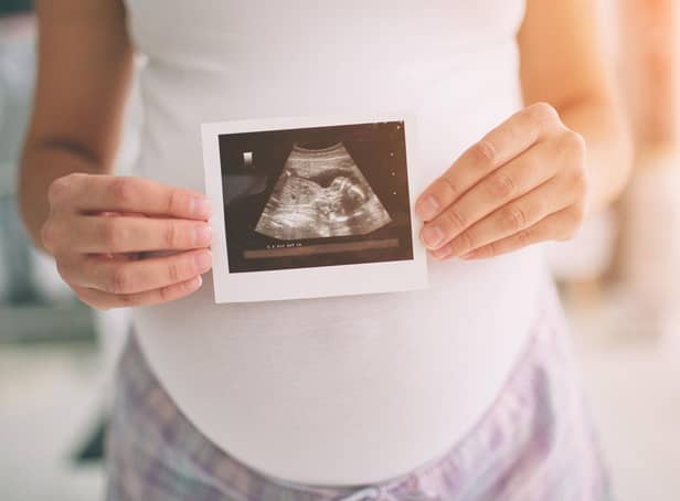 Pregnant women have been forced to attend scans alone