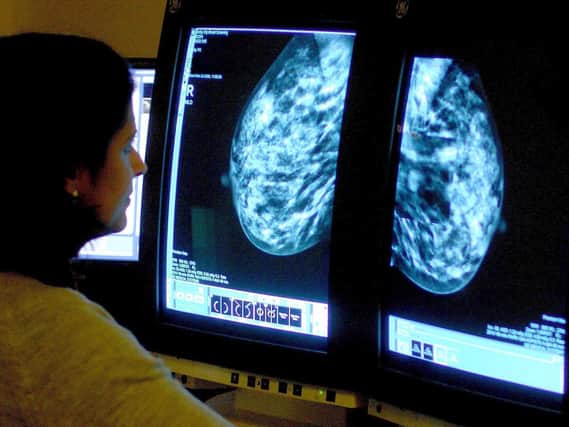 Almost a million British women have "missed" a breast cancer screening appointment because of the Covid-19 pandemic, a charity has estimated.