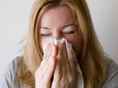 Sinusitis