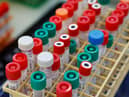 The rate of coronavirus infections across England and Wales appears to be slowing down
