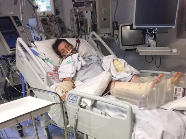 Lisa spent more than four weeks in a coma