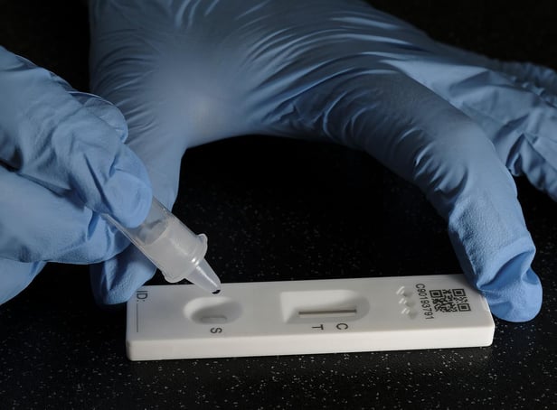 Scientists are testing a new oral treatment for coronavirus