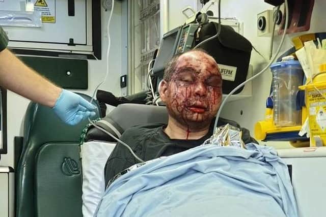 This man was brutally attacked in Skelmersdale