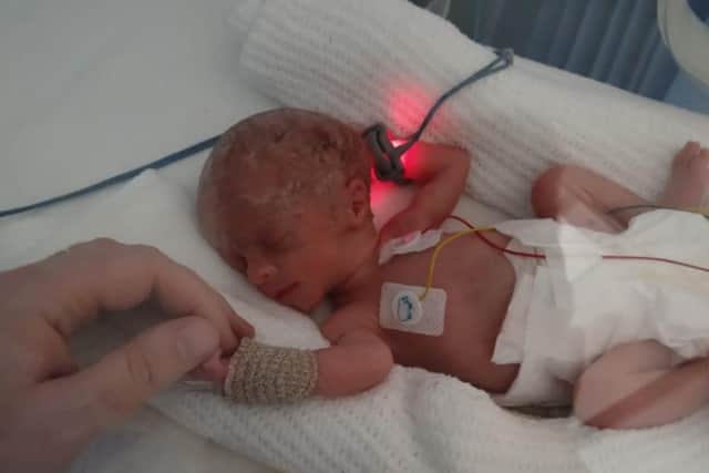 Abigail spent five weeks in hospital after her birth