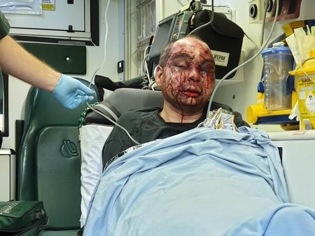 The man was seriously injured in the attack