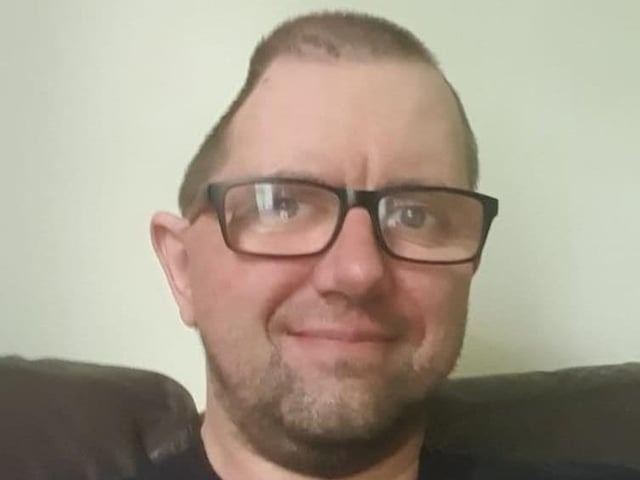 Karl Hawkins had part of his skull removed due to the brain haemorrhage