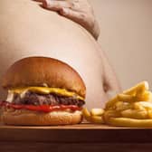 Thousands of people are admitted into hospital each year with conditions caused by obesity