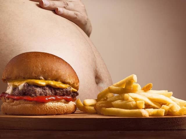 Thousands of people are admitted into hospital each year with conditions caused by obesity