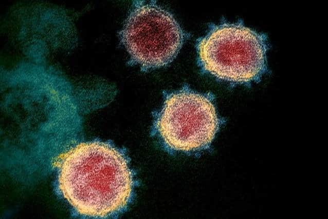 The number of deaths involving coronavirus registered each week in England and Wales has dropped below 100 for the first time in nearly nine months