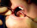 The British Dental Association said the pandemic has exacerbated longstanding problems in NHS dentistry