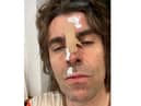 Liam Gallagher says he fell out of a helicopter