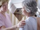 A routine mammogram is potentially life-saving