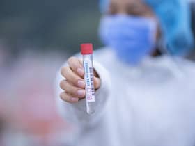PCR Tests are sent off for lab analysis