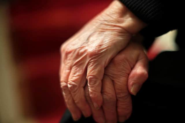 NHS England guidance gives a target for two-thirds of people suspected of having dementia to be officially diagnosed with the condition.