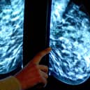 Anyone registered with a GP as female will be invited for NHS breast screening every three years between the ages of 50 and 71.