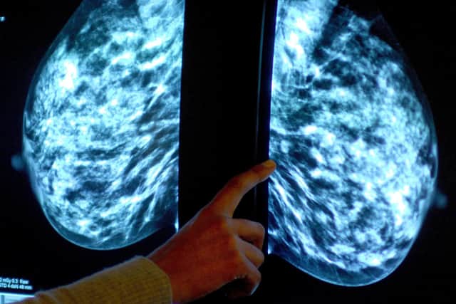 Anyone registered with a GP as female will be invited for NHS breast screening every three years between the ages of 50 and 71.