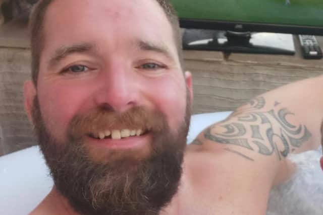 James Guy inflicted injuries from which his victim may never recover, Liverpool Crown Court heard