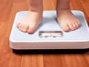 Child obesity action call.