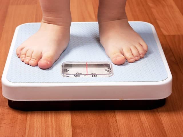 Child obesity action call.