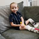 Levi Hewitt, five, wears splints as his legs recover from his battle with meningitis and sepsis