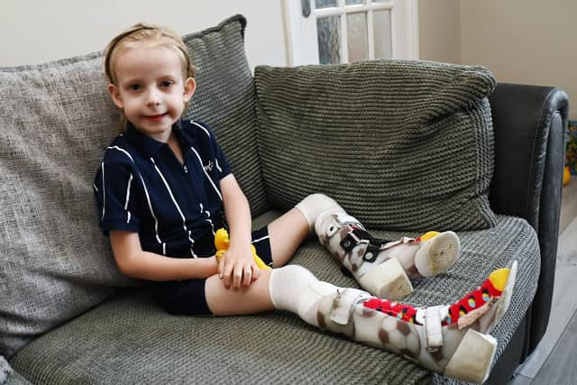 Levi Hewitt, five, wears splints as his legs recover from his battle with meningitis and sepsis