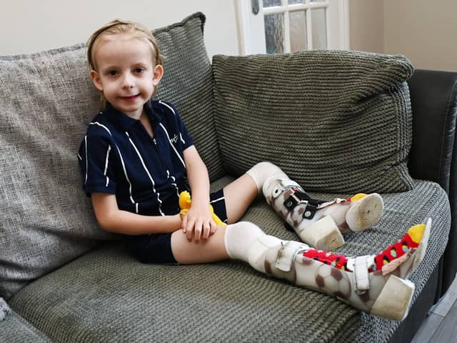 Levi Hewitt, five, wears splints as his legs recover from his battle with meningitis and sepsis