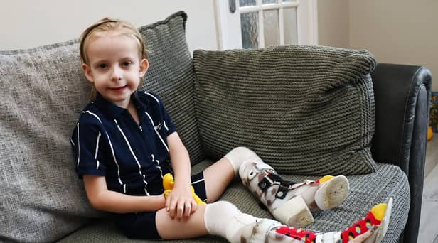 Levi Hewitt, five, wears splints as his legs recover from his battle with meningitis and sepsis