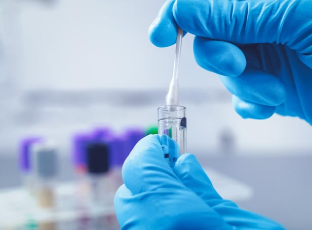Testing for coronavirus