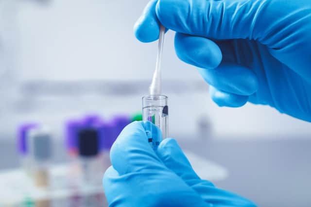 Testing for coronavirus