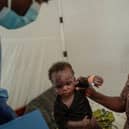 A child his helped by her mother as a health worker looks on at the Mpox treatment centre at Nyiragongo General Referral Hospital, north of Goma on August 17, 2024. With around 16,000 cases recorded since the beginning of the year, the DRC is the focus and epicentre of the epidemic that led the World Health Organisation (WHO) to trigger its highest level of alert at the international level on Wednesday. The province of South Kivu records around 350 new cases per week, according to Dr Justin Bengehya, epidemiologist at the provincial health division of South Kivu. Goma, capital of the province of North Kivu, almost surrounded by an armed rebellion and where hundreds of thousands of displaced people are crammed into makeshift camps, fears a large-scale spread due to promiscuity. (Photo by GUERCHOM NDEBO / AFP) (Photo by GUERCHOM NDEBO/AFP via Getty Images)