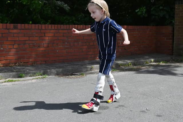 Five-year-old Levi Hewitt walks with splints
