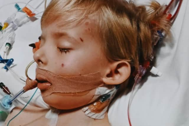 Levi Hewitt spent three months in hospital fighting meningitis and sepsis