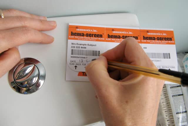 Bowel cancer screening test is being rolled out to more people