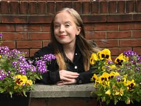 Melissa Jackson, 25, from Ashton-in-Makerfield, has kidney failure and is on dialysis three times a week as she waits for a kidney transplant