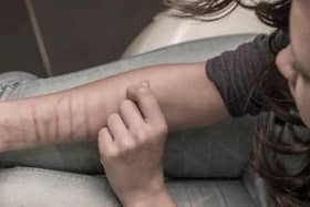 Well iover 200 WIgan women have ended up in hospital due to self-harming in the space of a year