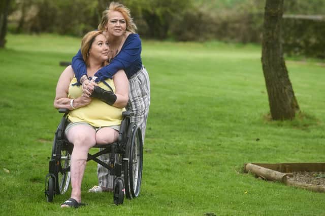 Emma Doherty has been left permanently disfigured and in a wheelchair after contracting necrotising fasciitis, also known as the "flesh-eating disease" and feels let down by support from the NHS.  She is pictured with her mum Marie Keane.